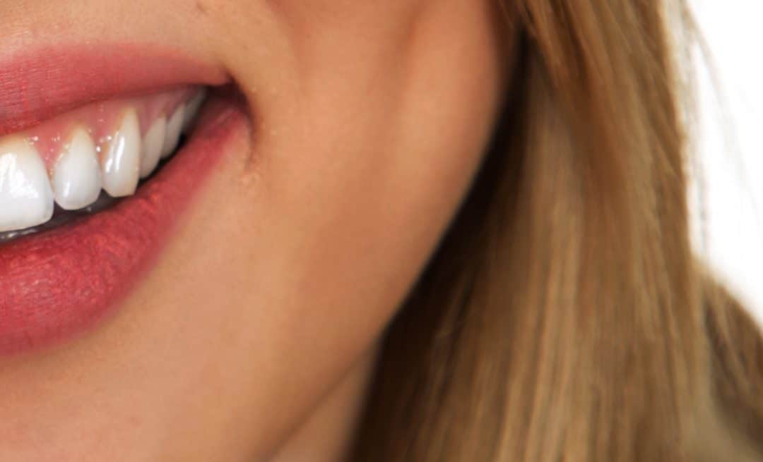 Igiene orale e salute della bocca rimedi naturali