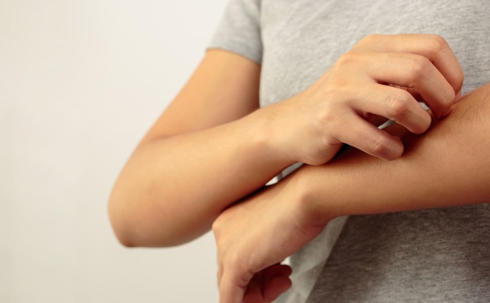 istamina intolleranza